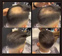 x2 Toppik Dark Brown + Aplicador Fibras Capilares - miniatura 2